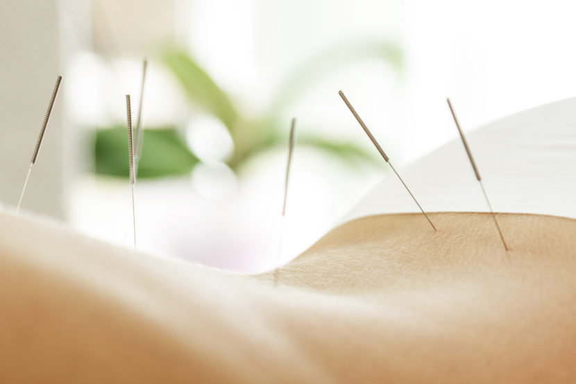 Acupuncture 101 with Karen Mastrangelo, founder of Acupuncture First